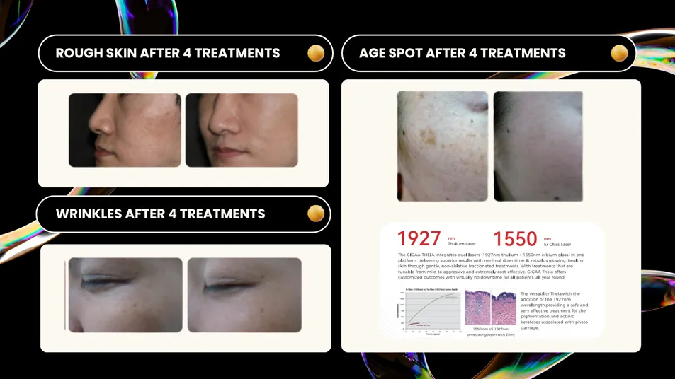 Skin Treatment Device