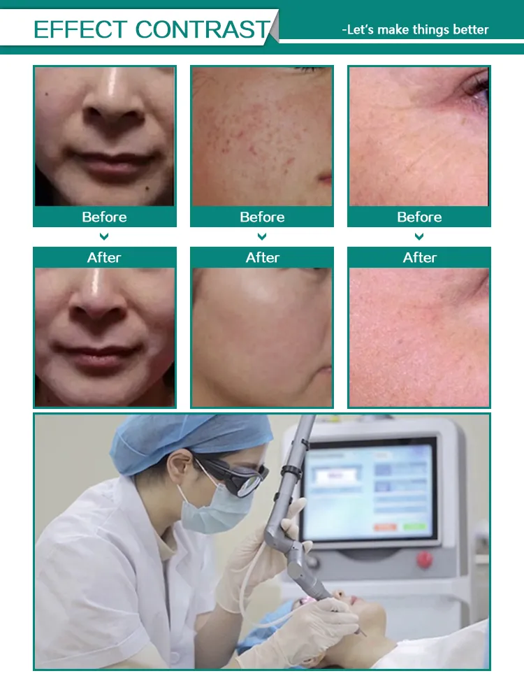 Before and After Results