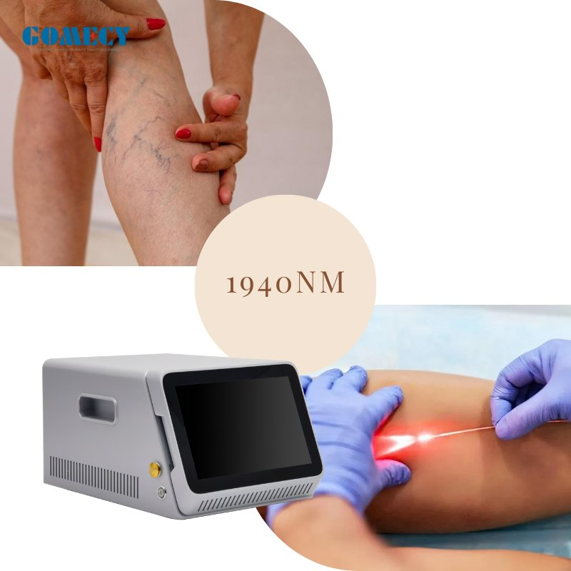 Advanced 1940nm Medical Laser System for Precise Vascular Vein Therapy Applications