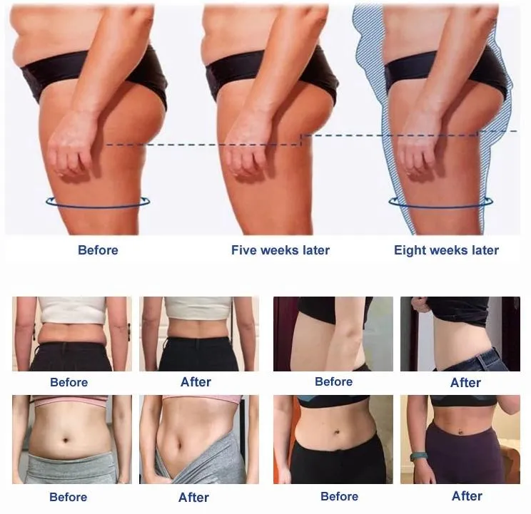 Skin Results
