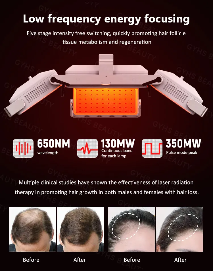 Hair Growth Device 7