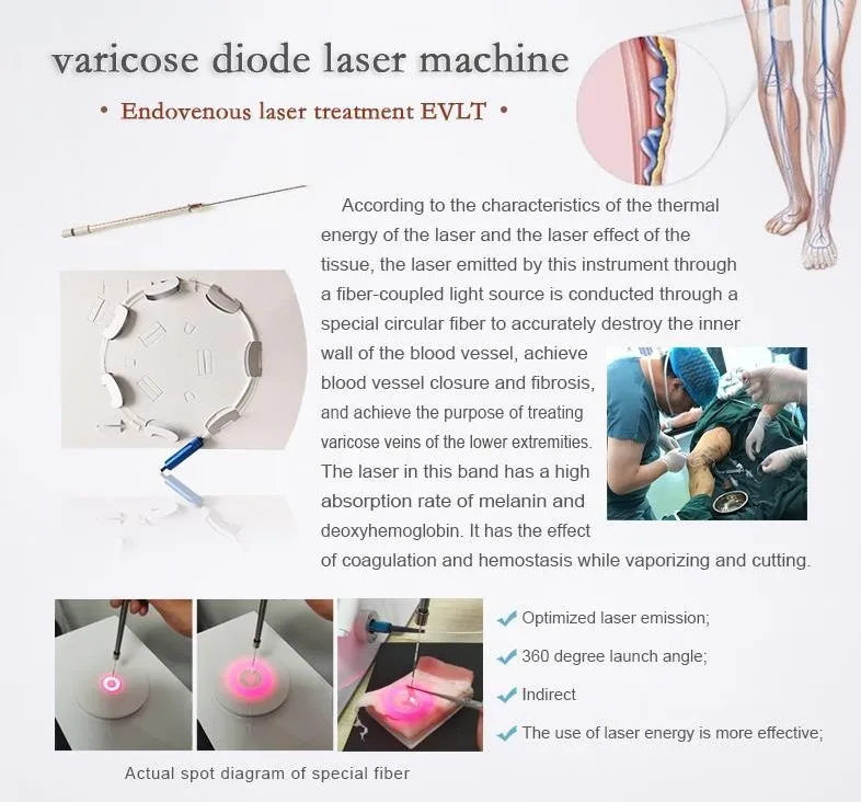 Laser Surgery
