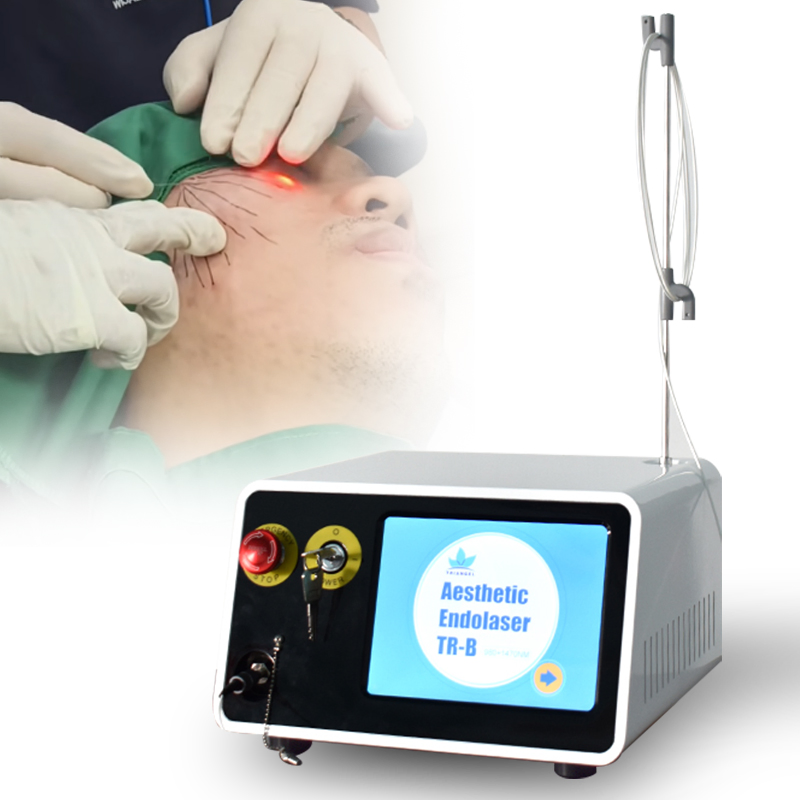 Diode Laser Lipolysis Liposuction Machine Facial Lipo Cellulite Reduction Endolift Laser Slimming