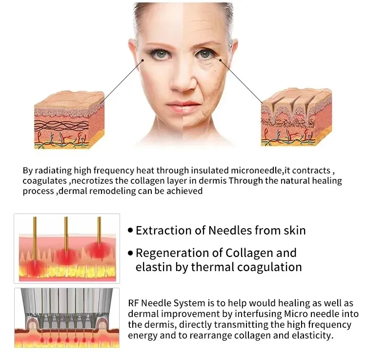 Treatment Detail 2