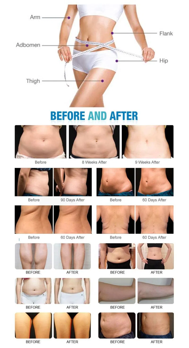 Before and After Treatment Results