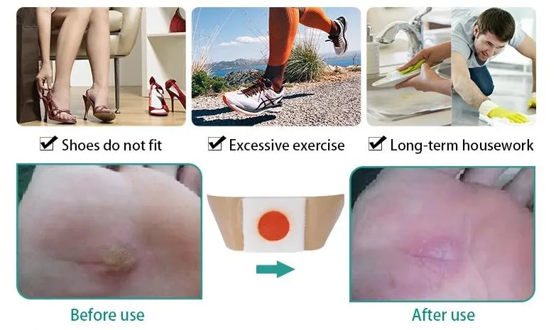 Bandage Application Scene