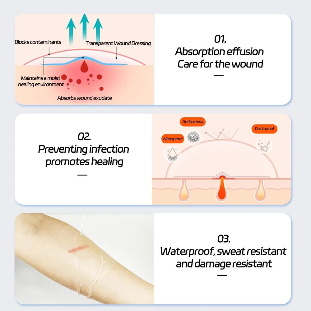 Medical Sterile Waterproof Dressing, Large Picc IV Cannula Patch, Transparent Film Dressing for Cesarean Section, Custom OEM Manufacturing