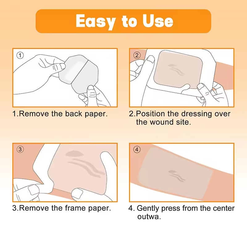 Carbou 15*20cm Breathable Waterproof Painless Removal Transparent Film Patch IV Catheter Dressing