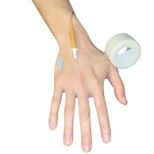 Non- Woven Transparent PE Surgical Medical Tape