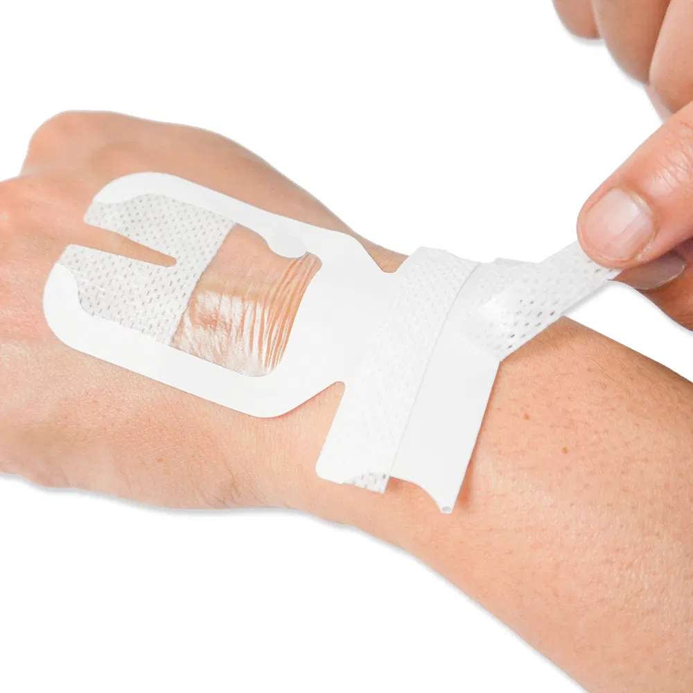 IV Cannula Dressing Photo 1