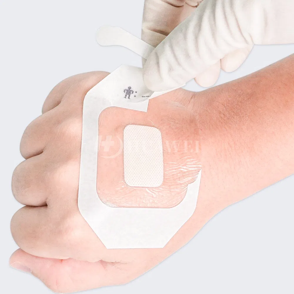 Medical IV Fixation Dressing with with Hydrocolloid Pad Transparent Waterproof Adhesive Patch for Cannula Protection