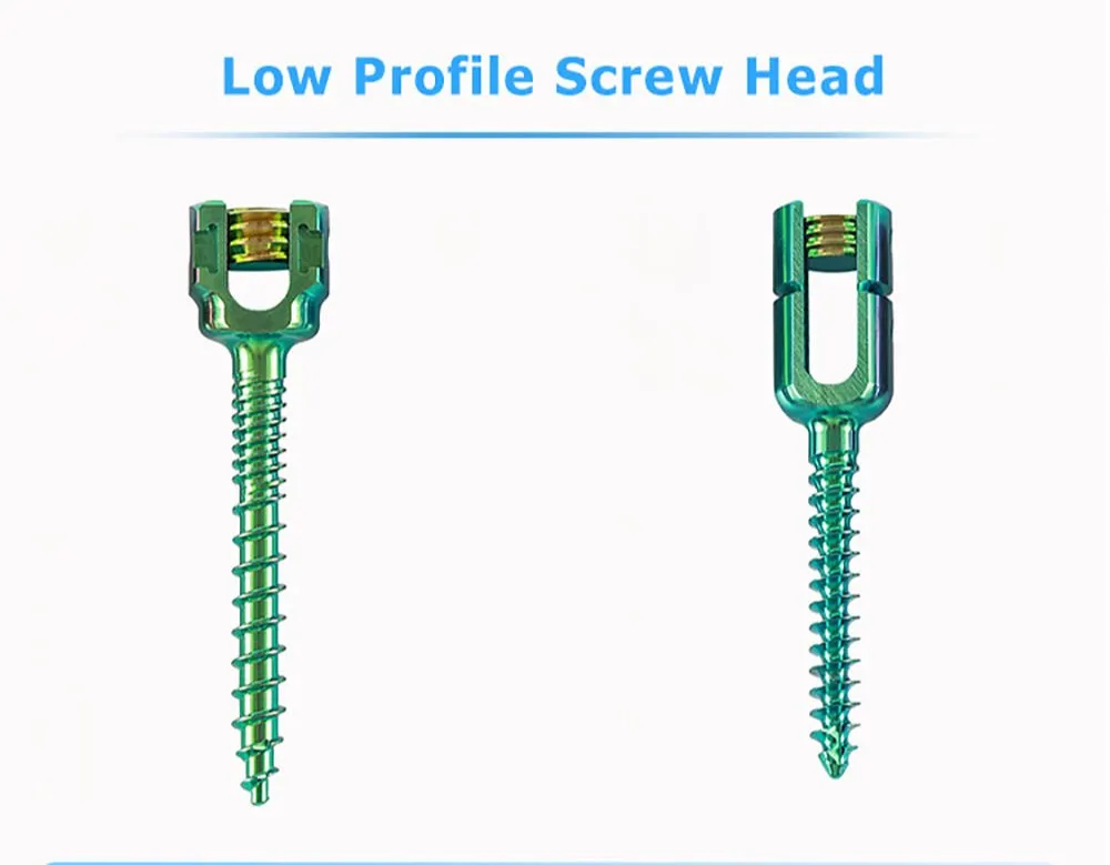 Screw Head Design