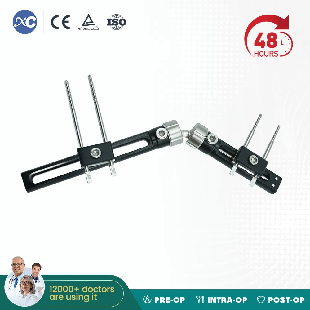 Orthopedic Implants and Instrument Unilateral Wrist External Fixator for Fracture Stabilization