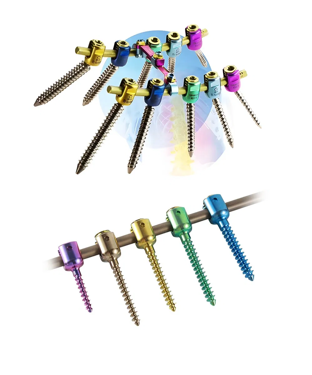 6.0mm Spinal Pedicle Screw System