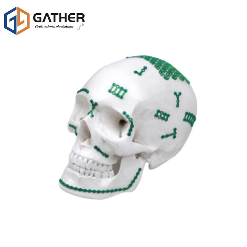 Ym-Type Maxillofacial Plates Plastic Cosmetic Surgery Orthopedic Implant