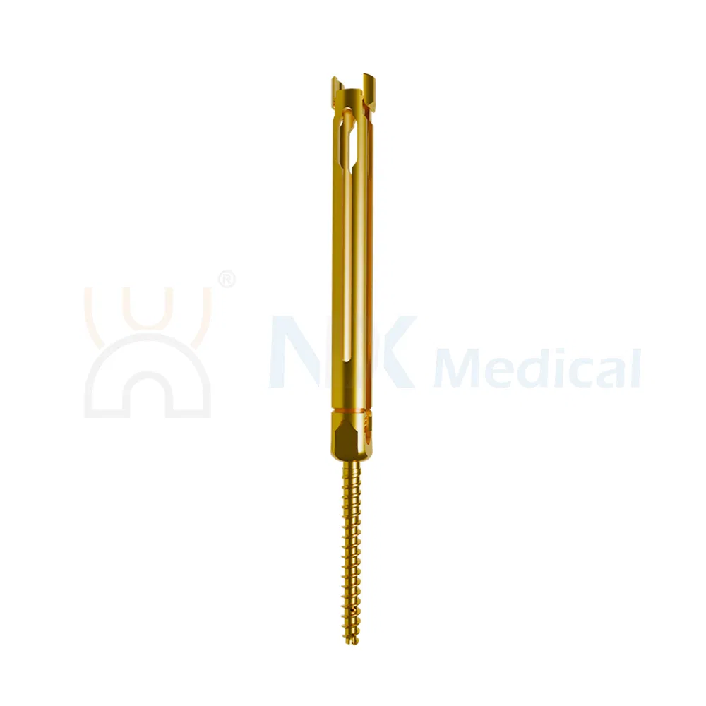 Nx Medical Sf-IV Mis Cannulated Bone Cement Spinal Pedicle Screw 5.5mm System