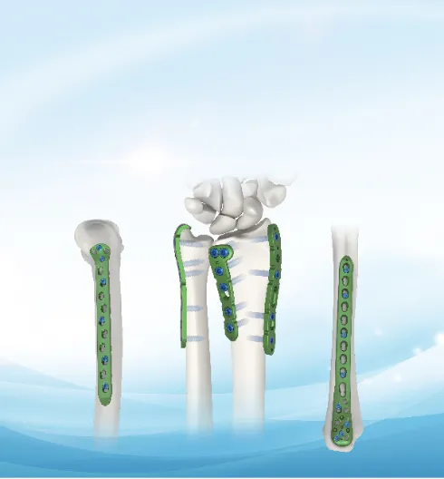 Related Spinal Implant 1