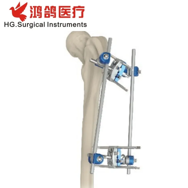 Orthopedic External Fixator View 4