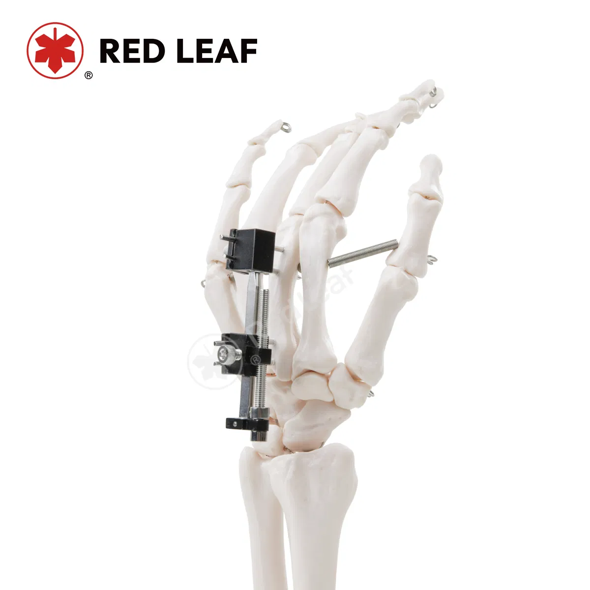 Universal Mini Palm External Fixator for Finger Fracture Orthopedic Surgical