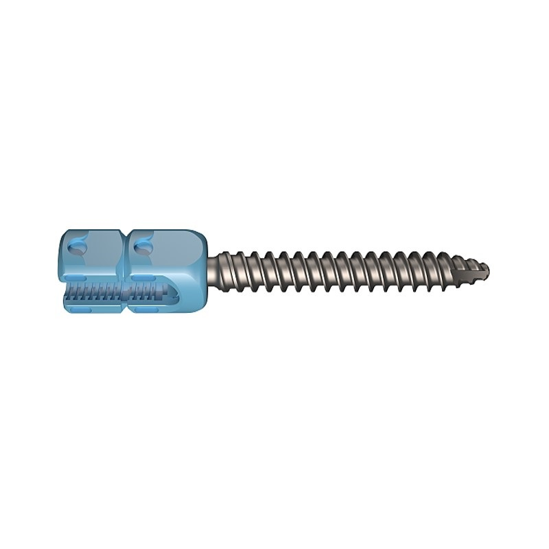 Spine Surgical Pedicle Screw Titanium Surgery Orthopedic Implants Posterior Thoracolumbar Spinal Fixation System