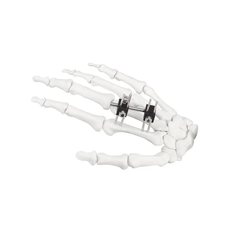 Surgical Instruments Mini Fixator Universal Type