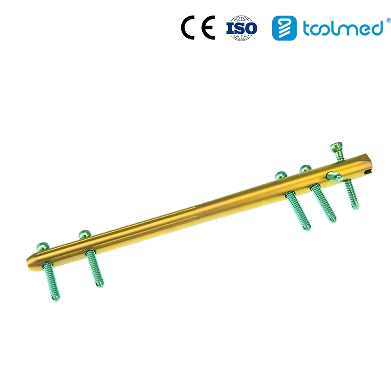 Orthopaedic Implant Trauma Expert-Level Femoral Retrograde Intramedullary Nail