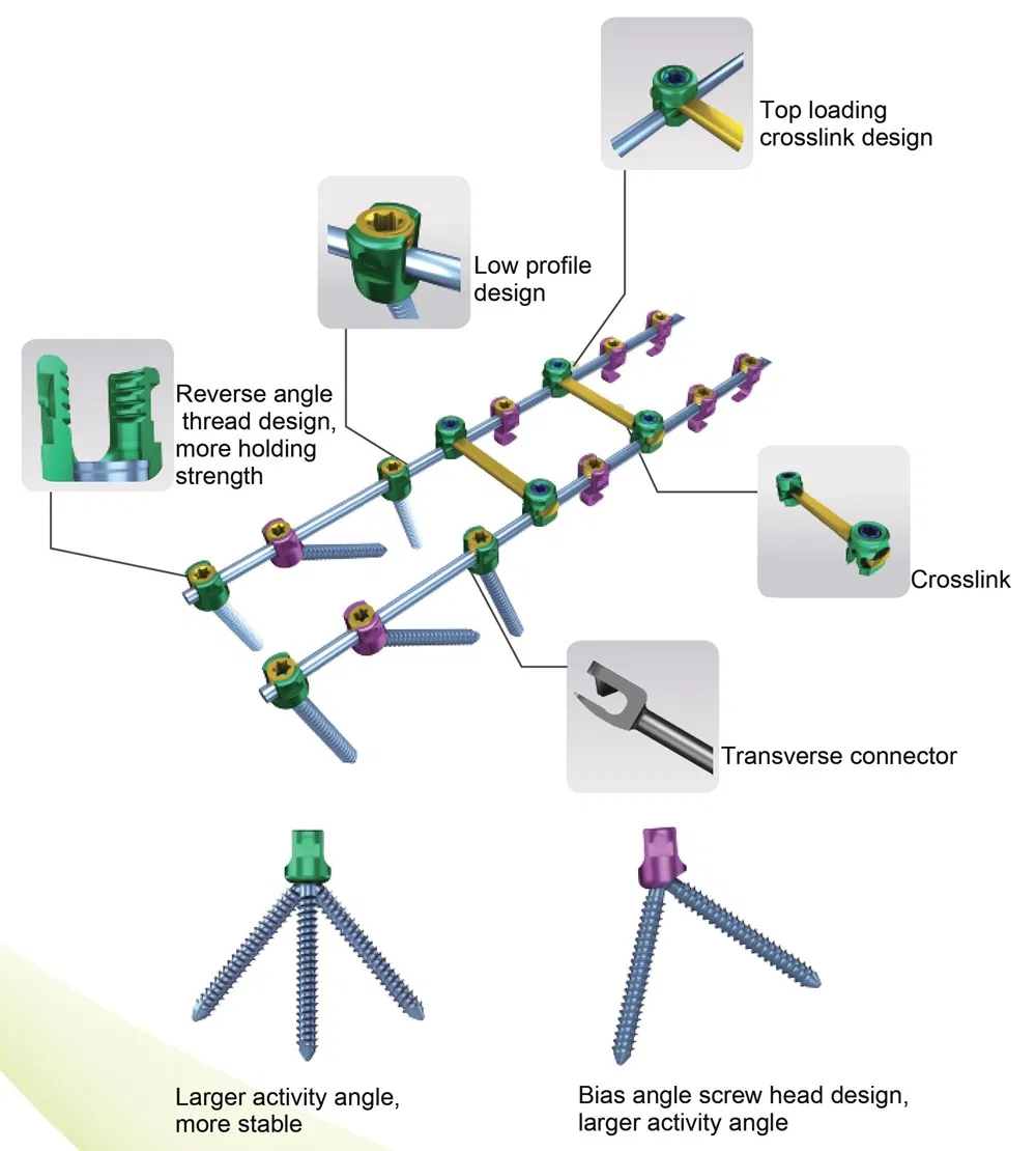 Pedicle Screw Fixation System