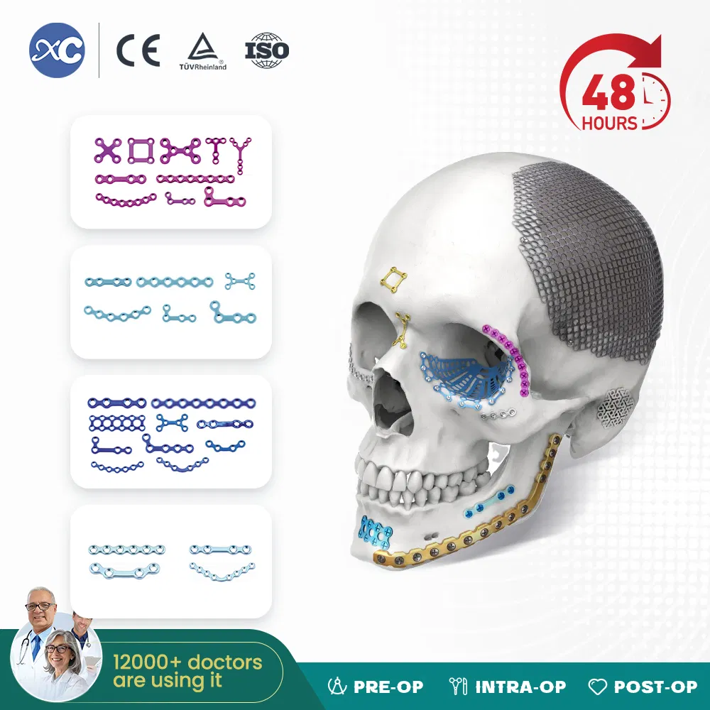 Cmf System Titanium Material Orthopedic Surgery Maxillofacial Locking Plates and Screws Implant