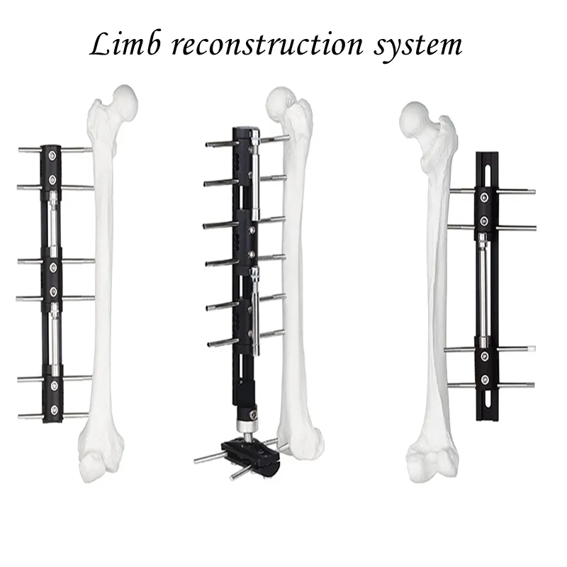 External Fixator Components