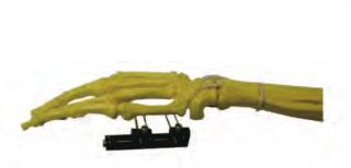 Surgical Orthopedic Mini Fixatior-Universal External Fixator