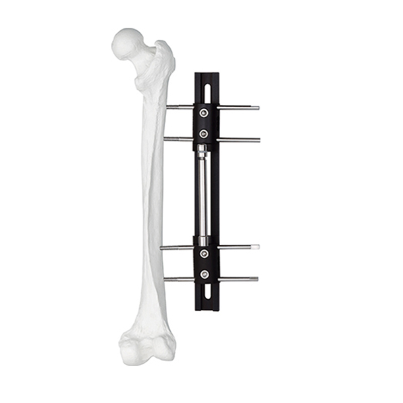 Limb Reconstruction External Fixator B Type for Orthopedic Fixation