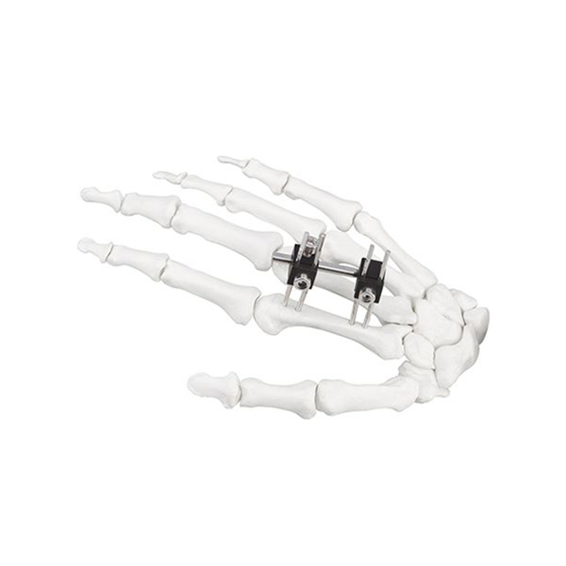 Surgical Instruments Mini Fixator Universal Type for Orthopedic Fixation