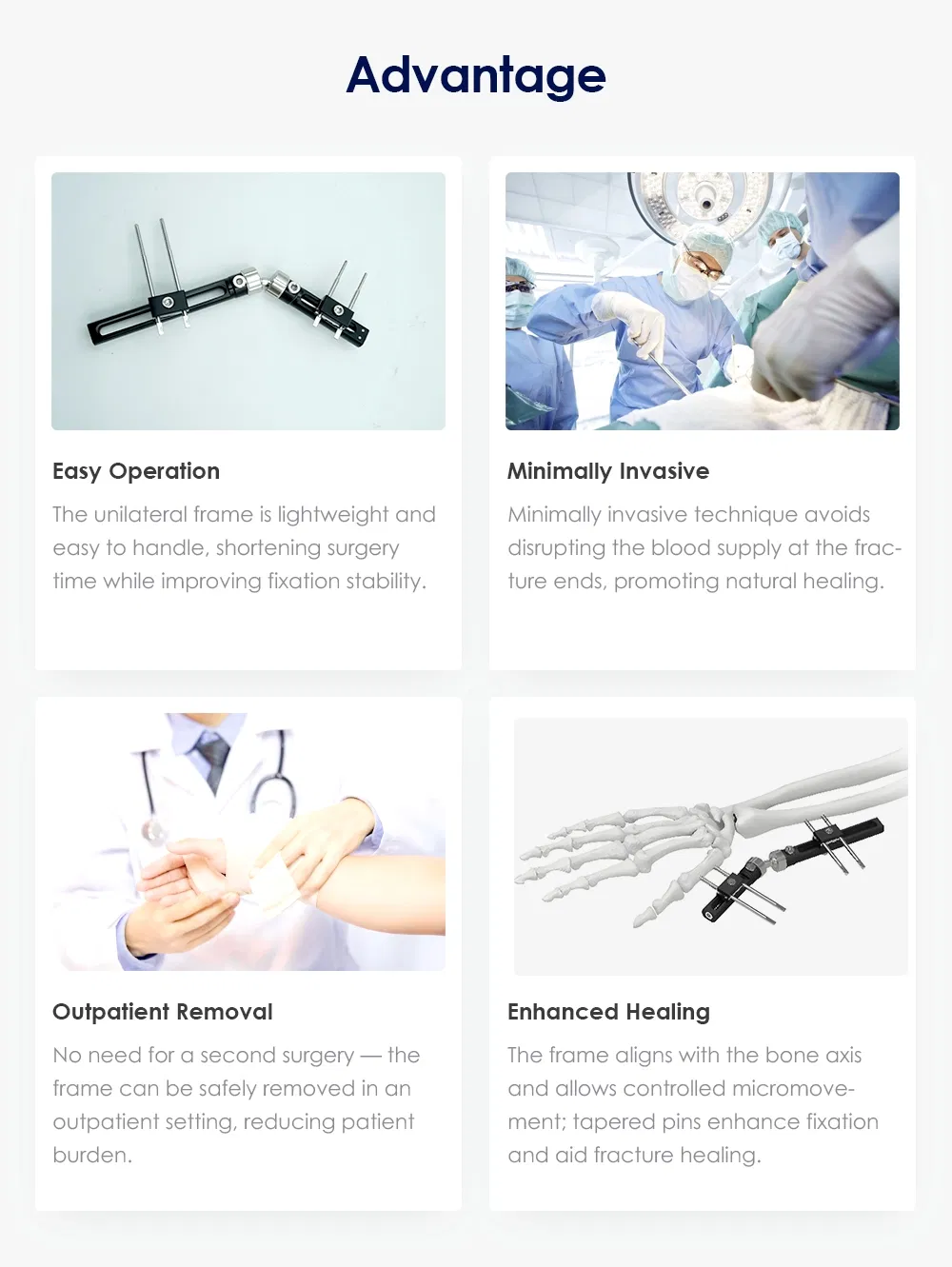 Fracture Stabilization System
