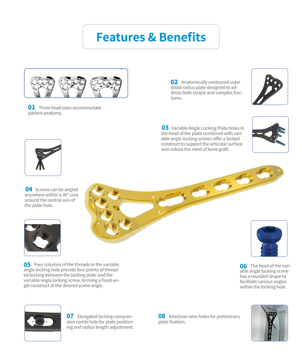 Volar Distal Radius Locking Plate