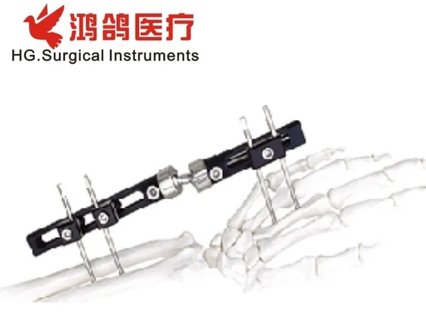 Orthopedic Fixation Device