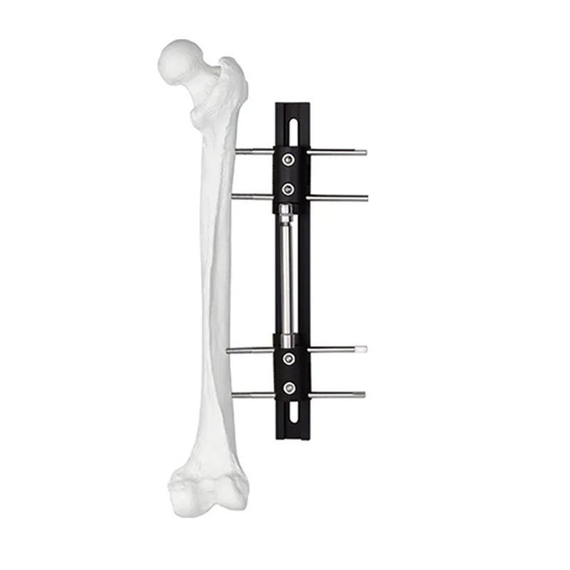 Limb Reconstruction External Fixator B Type