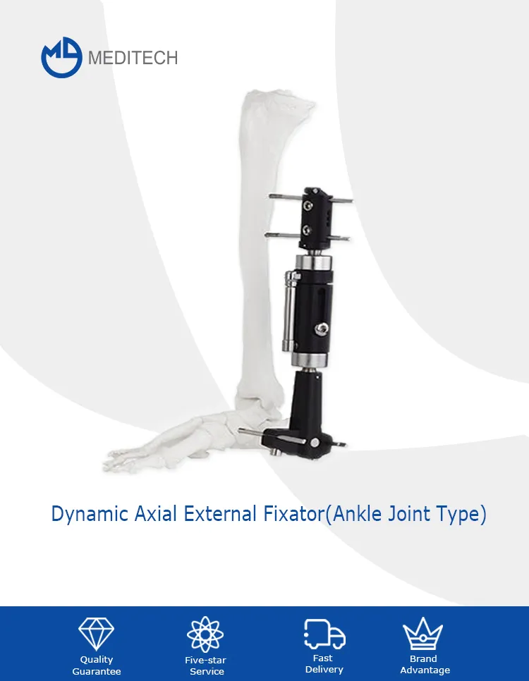Ankle Joint Fixator 1