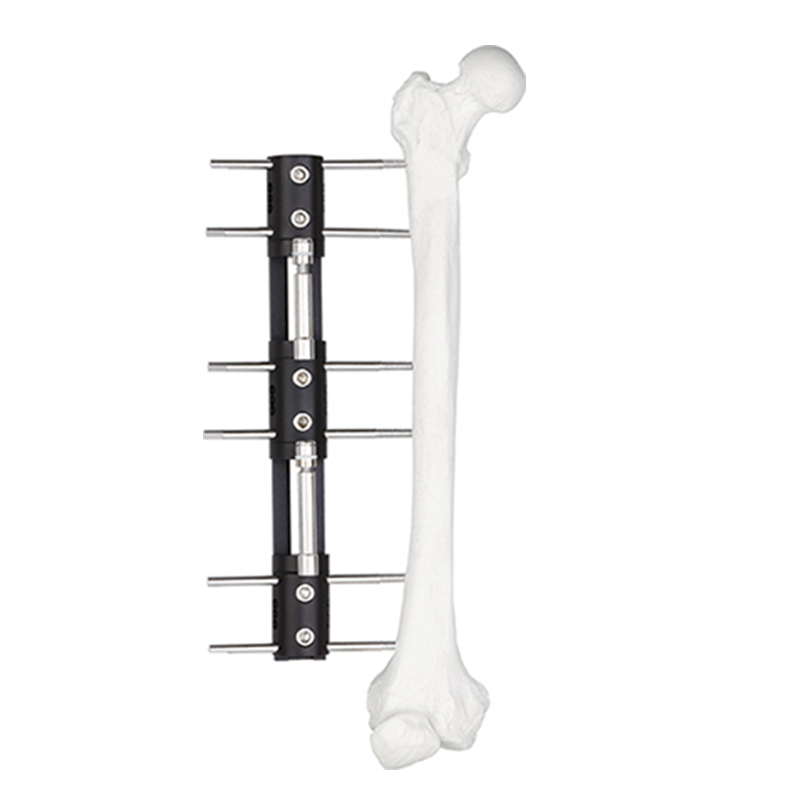 Limb Reconstruction External Fixator B Type for Orthopedic Fixation