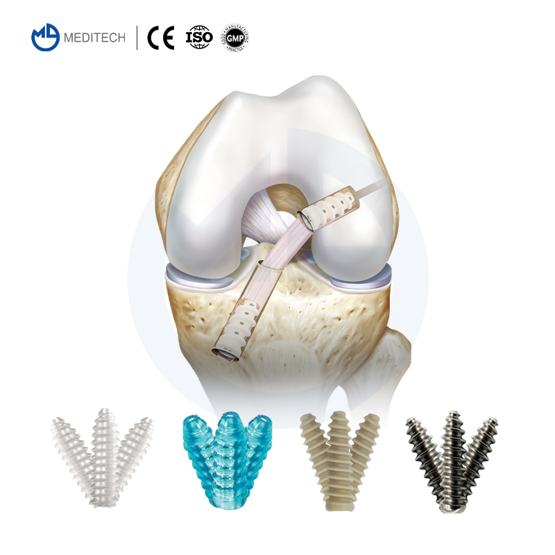 Sports Medicine Tibial Ligament Reconstruction Implants Peek Interference Screw