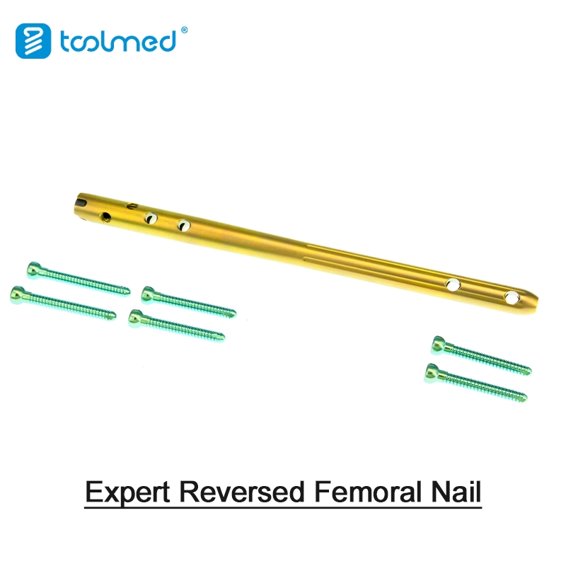 Orthopaedic Implant Trauma Expert-Level Femoral Retrograde Intramedullary Nail