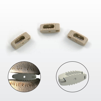 Surgical Instrument Orthopedic Implant Titanium Coating Bullet Lumbar Peek Interbody Fusion Cage Spine System