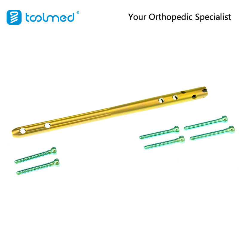 Orthopaedic Implant Trauma Expert-Level Femoral Retrograde Intramedullary Nail