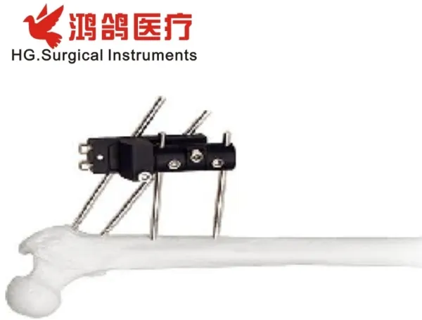 Orthopedic Instrument Dynamic Axial External Fixator
