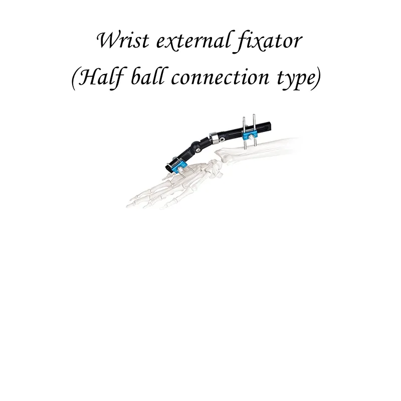 Single-Sided Integrated Wrist External Fixator