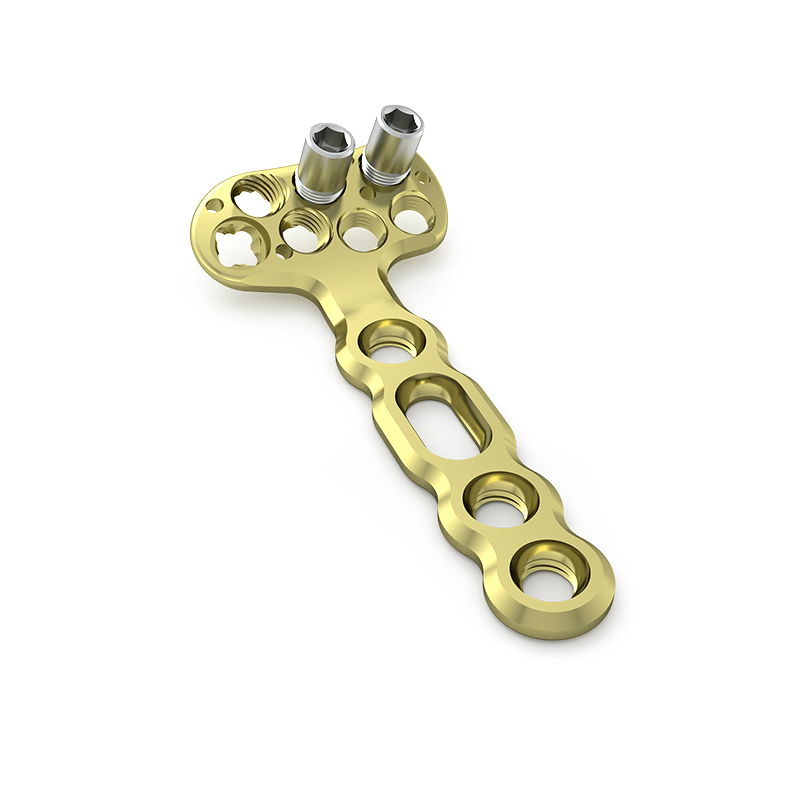 Colorful Distal Radius Locking Plate