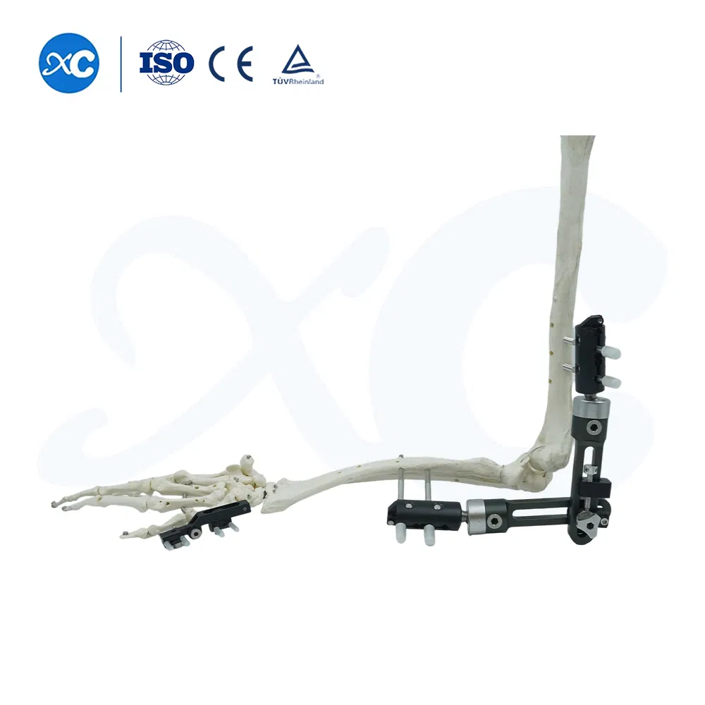 Factory Direct Supply High Quality Small Fragment External Fixator Orthopedic Medical