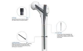 Orthopedic Tibia Intramedullary Nail