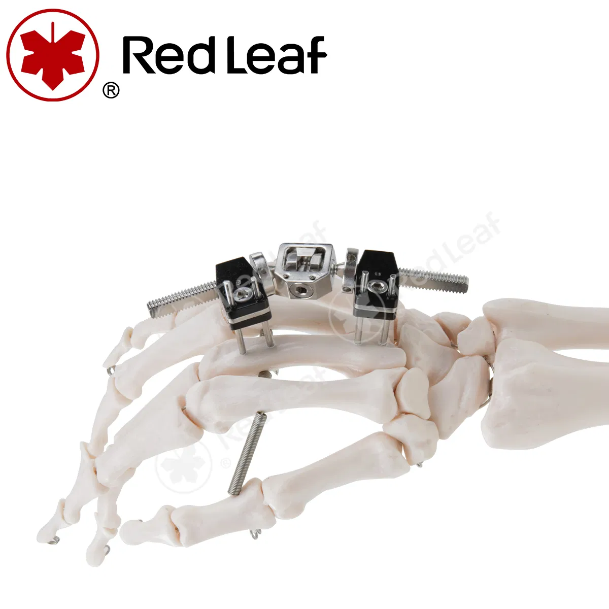 Professional Medical Orthopedic Fixation Mini Joint Motion Type External Fixator