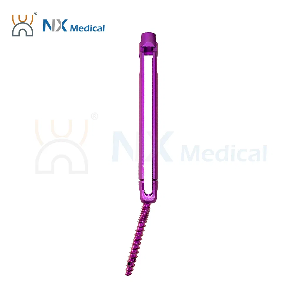 Nx Medical Orthopedic Implant Cannulated Bone Cement Pedicle Screw Spine Bone Fixation