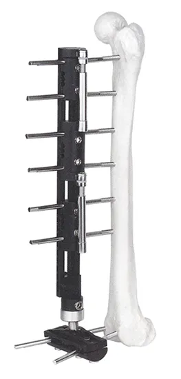 LRS C Fixator
